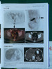zhongliu PET/CT成像图谱：病例解析 商品缩略图2