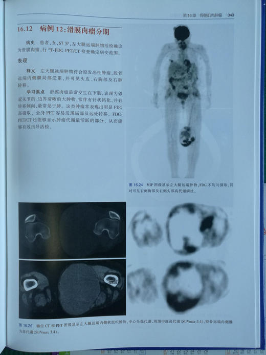 zhongliu PET/CT成像图谱：病例解析 商品图8