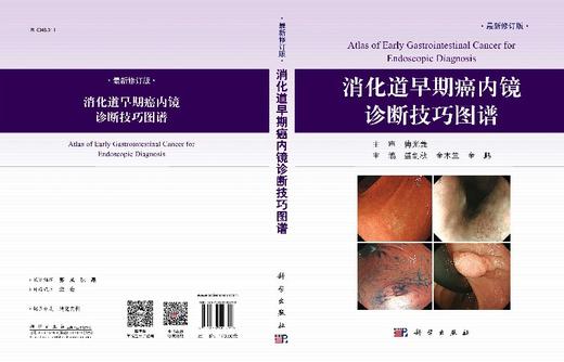 消化道早期癌内镜诊断技巧图谱（修订版）盛剑秋，金木兰，金鹏 商品图3