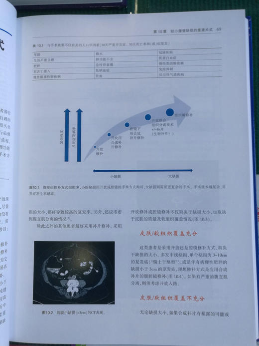 现代疝外科学：理论与技术 商品图6