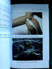 超声引导下肌肉骨骼注射治疗（ 天津科技翻译出版社） 商品缩略图3