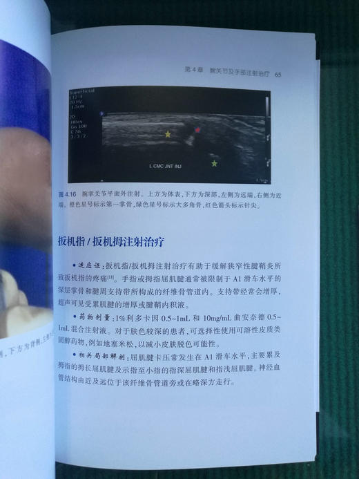 超声引导下肌肉骨骼注射治疗（ 天津科技翻译出版社） 商品图5