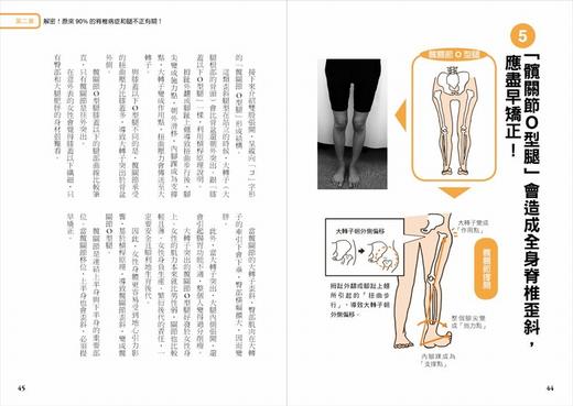 【中商原版】腿型回正：改变10万人の不酸痛直腿密技！骨科权威名医教你，O型腿、X型腿都能自癒！ 港台原版 笠原岩 瑞丽美人出版 商品图2