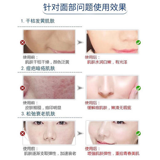 【祛痘洗面奶】LION PAIR狮王祛痘洗面奶 快速去痘去闭口粉刺暗疮抗菌洁面 商品图3