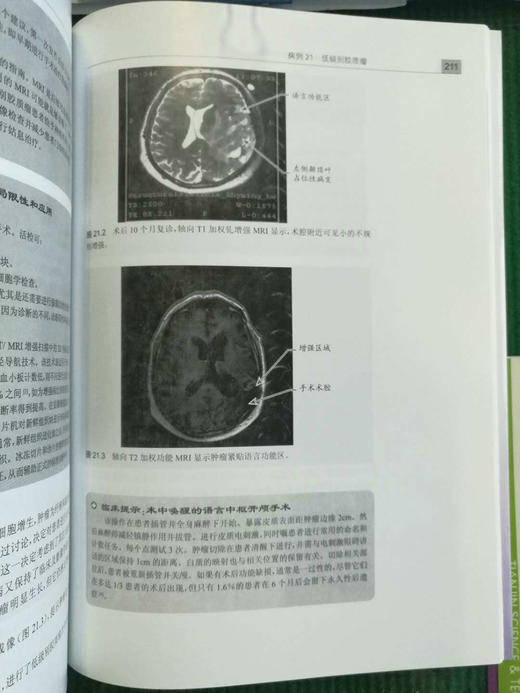 神经外科典型病例的难点与对策 商品图5