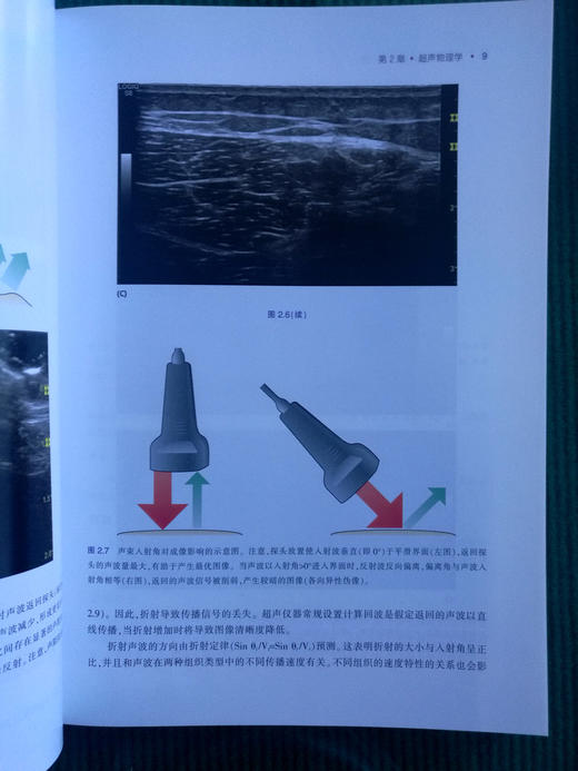 肌肉骨骼超声基础：入门篇 商品图2