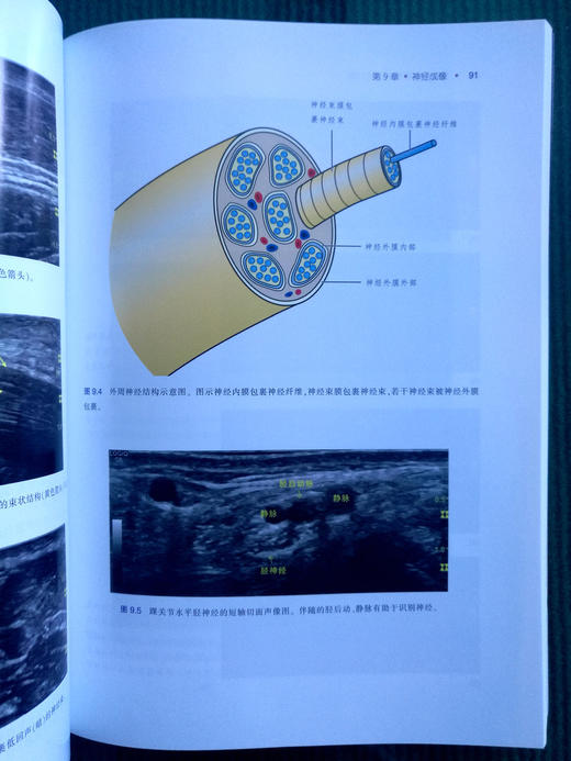 肌肉骨骼超声基础：入门篇 商品图4