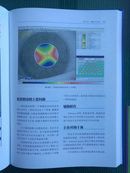 屈光手术疑难病例解析 商品图4