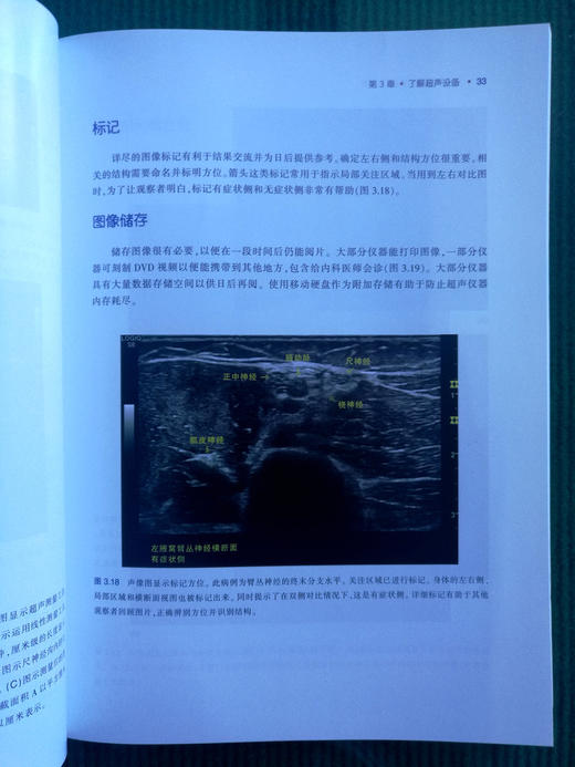 肌肉骨骼超声基础：入门篇 商品图6