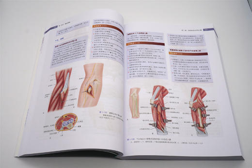 普及版 坎贝尔骨科手术学（第13版）丛书 北医社  唐佩福 王岩 卢世璧 主译 商品图10