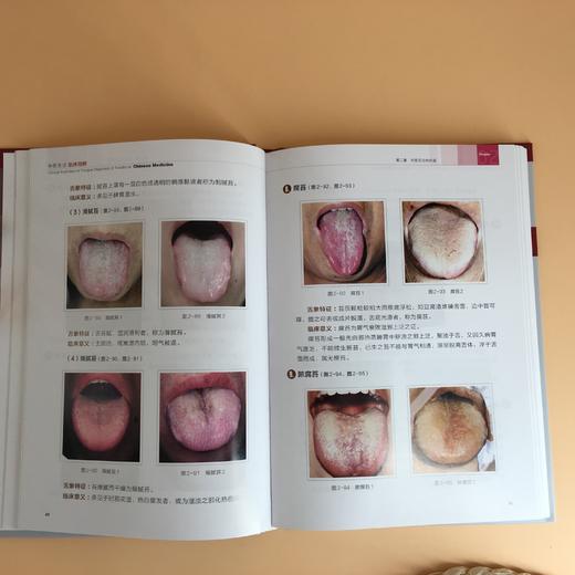中医舌诊临床图解 商品图2