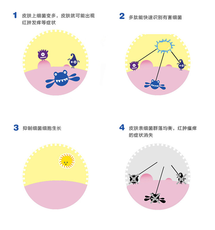 martempo 海得寶皮膚護理凝膠 / 蚊蟲叮咬抑菌凝膠!