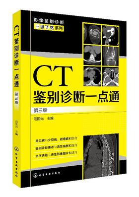 影像鉴别诊断一目了然系列--CT鉴别诊断一点通（第三版）