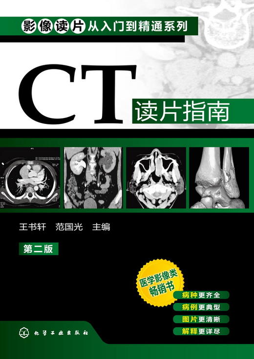 影像读片从入门到精通系列--CT读片指南(二版) 商品图1