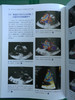 围术期3D经食管超声心动图图谱：病例与视频（天津科技翻译出版社） 商品缩略图4