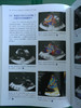 围术期3D经食管超声心动图图谱：病例与视频 商品缩略图8