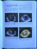 围术期3D经食管超声心动图图谱：病例与视频（天津科技翻译出版社） 商品缩略图6