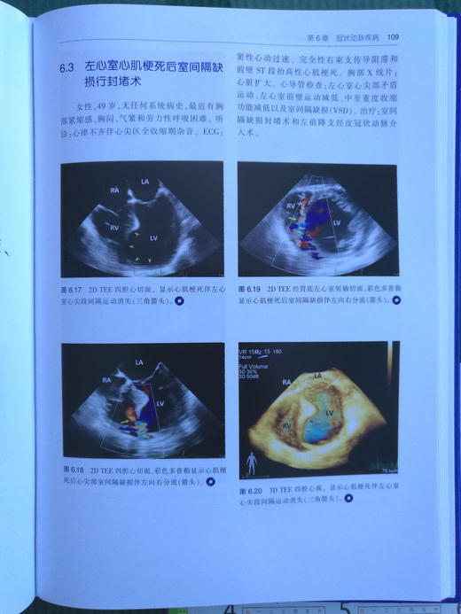围术期3D经食管超声心动图图谱：病例与视频（天津科技翻译出版社） 商品图6