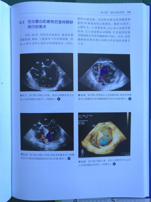 围术期3D经食管超声心动图图谱：病例与视频 商品图6