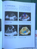 围术期3D经食管超声心动图图谱：病例与视频（天津科技翻译出版社） 商品缩略图5