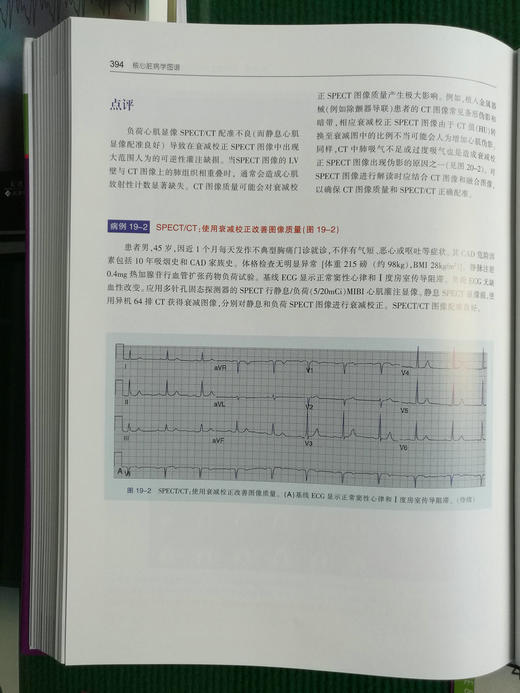 核心脏病学图谱 商品图8