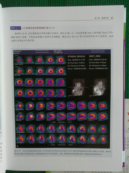 核心脏病学图谱 商品图4