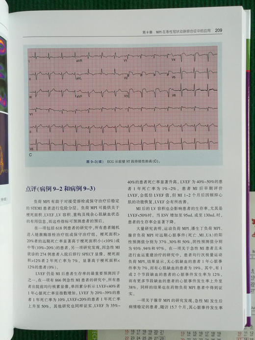 核心脏病学图谱 商品图11