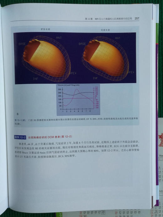 核心脏病学图谱 商品图6