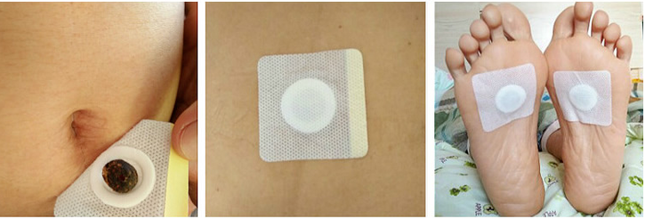 买3送1南师配方懒人艾灸贴肚脐贴30粒盒