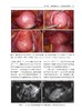 辅助生殖时代的生殖外科手术学 主译 关菁 沈浣 副主译 郑兴邦 北医社 商品缩略图3