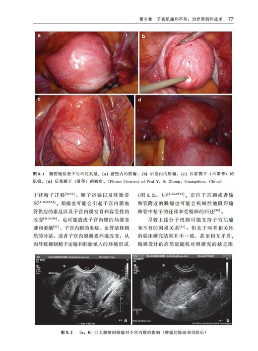 辅助生殖时代的生殖外科手术学 主译 关菁 沈浣 副主译 郑兴邦 北医社 商品图3