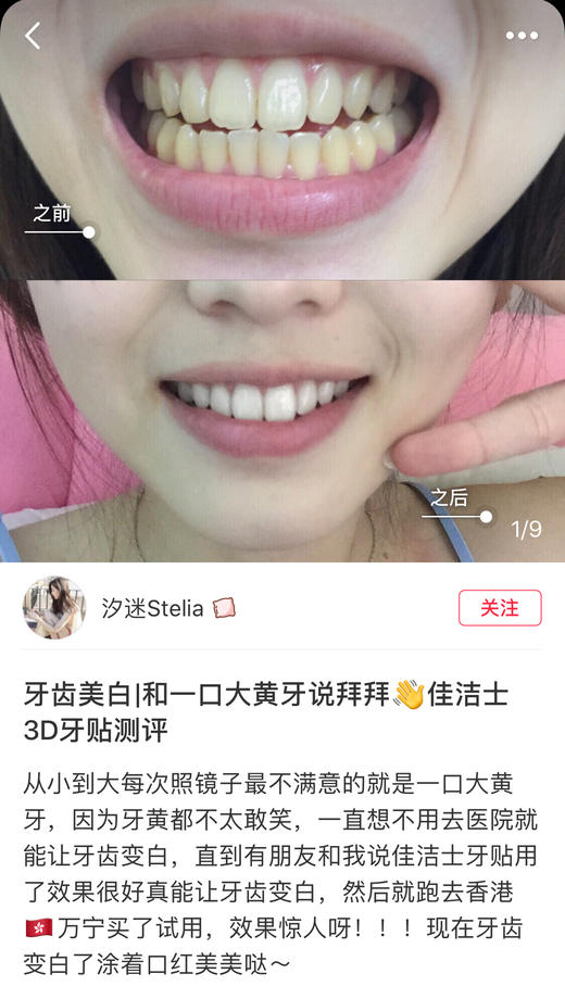 永别了大黄牙！Crest美白牙贴2盒超值装 商品图12