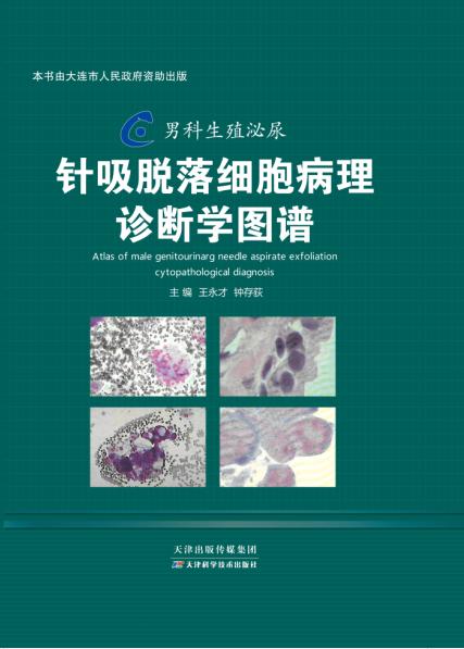 男科生殖泌尿针吸脱落细胞病理诊断学图谱 商品图0