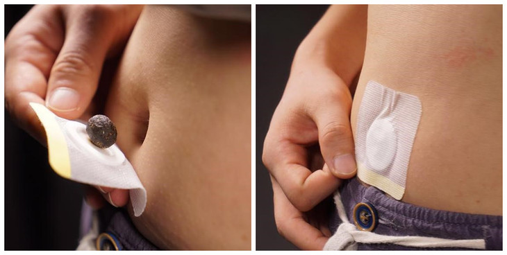 南师肚脐贴旧版放入仓库