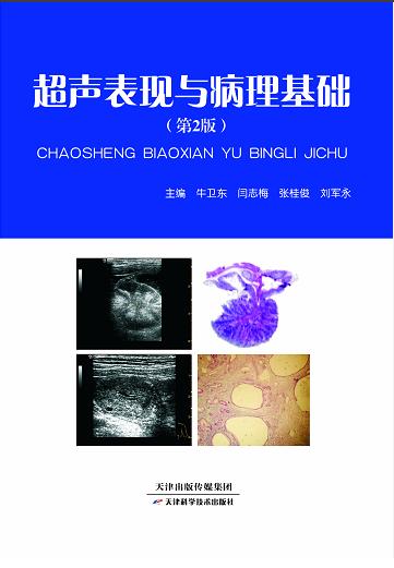 超声表现与病理基础 商品图0