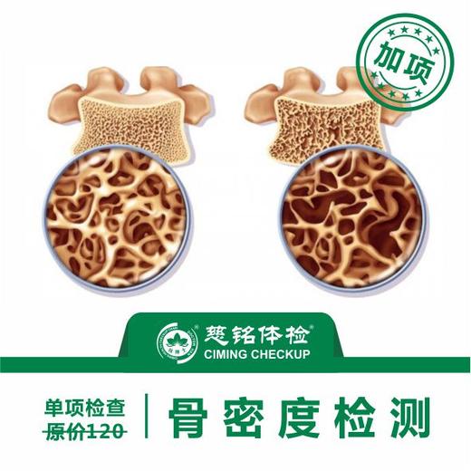 骨密度检测