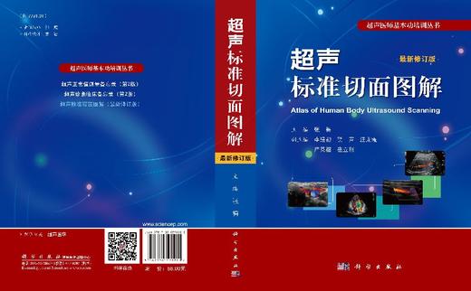 【官方】超声标准切面图解（修订版）张梅 商品图3