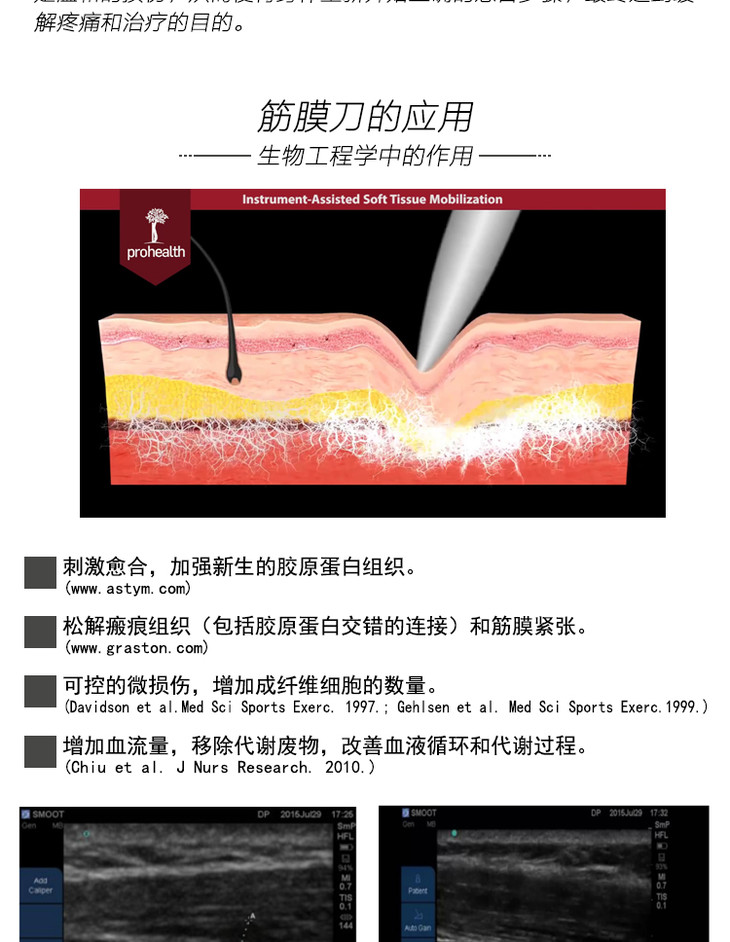 athlaxiastm肌筋膜刀理療工具筋膜刀鬆解刀軟組織輔助鬆解技術