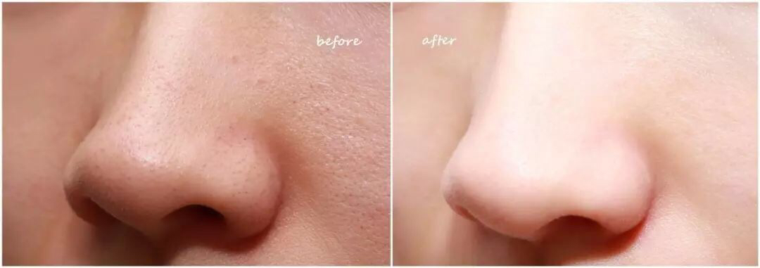 香奈儿茹雪水光蚕丝面膜