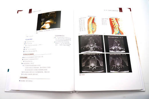 微创脊柱外科手术技巧 主译：文天林，蒋毅，杨晋才 商品图2