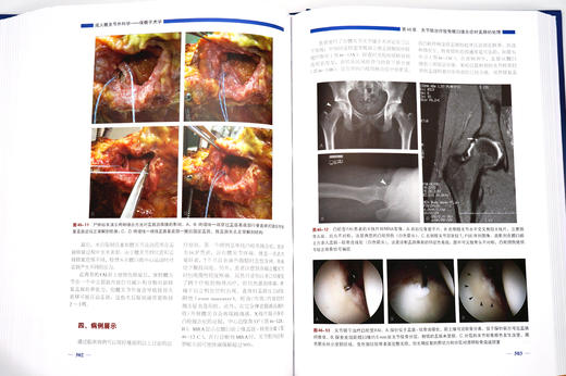 成人髋关节外科学——保髋手术学 主译：陈晓东，张先龙，张洪 商品图3