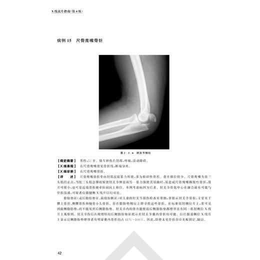 X线读片指南（第4版）    精装开本 商品图1
