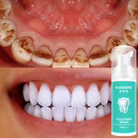 牙齿口腔清洁护理泡沫，去除口臭、黄牙蛀牙！清新口气洁牙慕斯