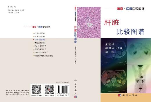 肝脏比较图谱 商品图3