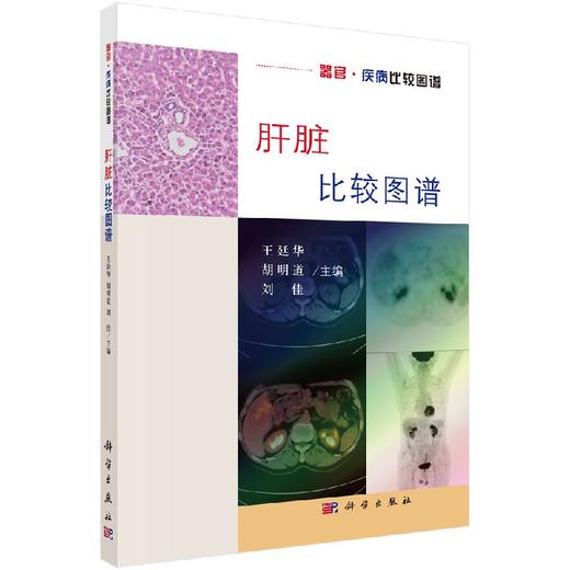 肝脏比较图谱 商品图0