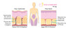 德诺海科THERASCIENCE CELLULITE抗橘皮营养胶囊30粒装 商品缩略图3