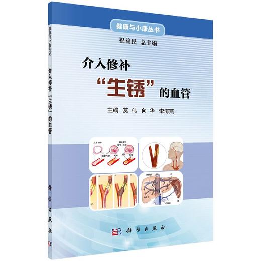 介入修补生锈的血管/莫伟 向华 李海燕 商品图0