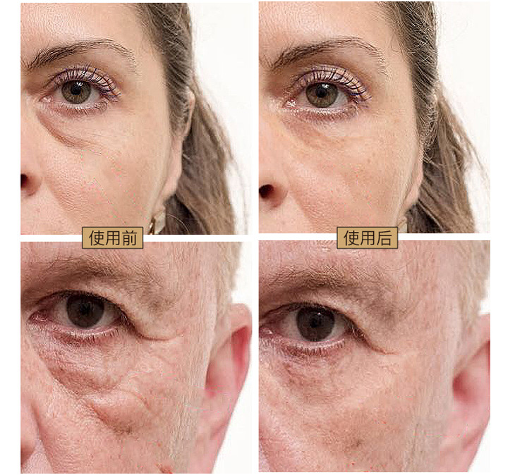 以色列即时祛皱眼霜抹掉眼袋鱼尾纹