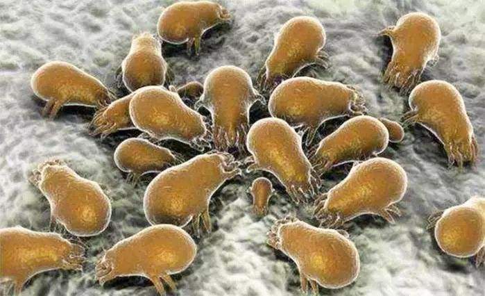 显微镜下的黑头粉刺图片