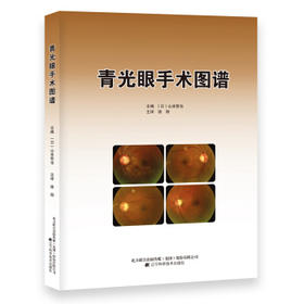  青光眼手术图谱 